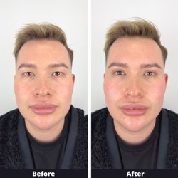 QCW B&A