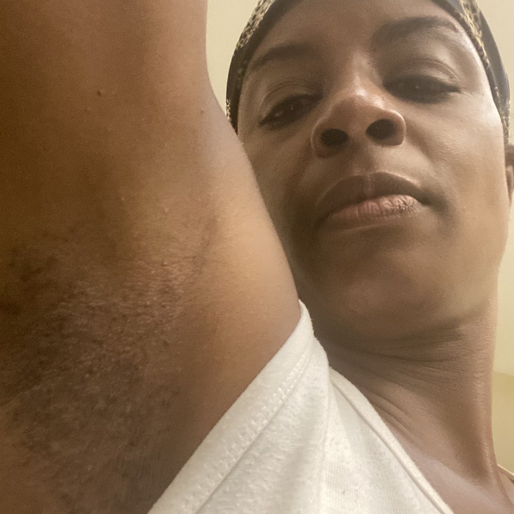 illumeMD - Medical Spas Near Me - Concord, North Carolina illumeMD - Medical Spas Near Me - Concord, North Carolina