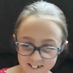 Hardy Orthodontics - Before