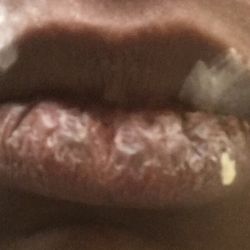 Advanced Dental Care - Ever seen a dentist that finishes his work and leaves your mouth like this...