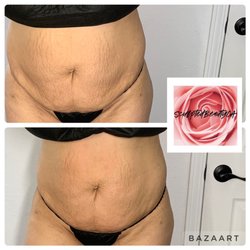 Sculpted Beauty - 1 Treatment of a two hour body sculpting session