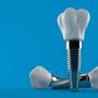 Channel Islands Oral and Maxillofacial Surgery
