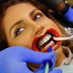 The Bright Spot - Teeth Whitening