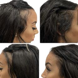 Natalie Hair Design - Scalp Micro Pigmentation on temples