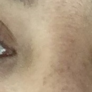 Vivace Lash Pro - Lashes on the first day done - Eyelash Service Near Me - Forest Hills, New York Vivace Lash Pro - Lashes on the first day done - Eyelash Service Near Me - Forest Hills, New York