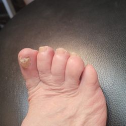 Gelicious Nails - It will take over a year to see much improvement