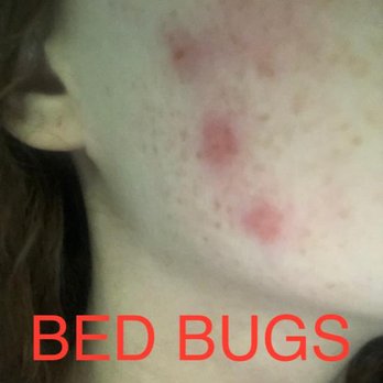 John Yancey Oceanfront Inn - Bed Bugs!!!! Don't Stay here!!! - Hotels Near Me - Kill Devil Hills, North Carolina