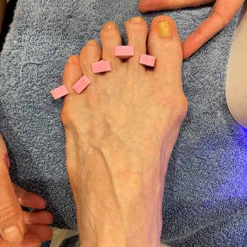 Le Le Nails - After my feet were cleaned up enough to get polish. - Nail Salons Near Me - Timonium, Maryland