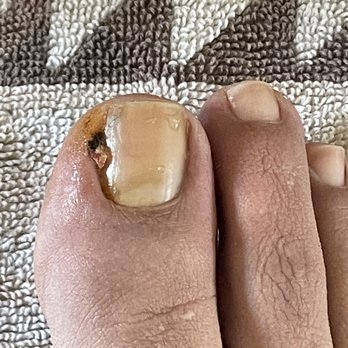 IMPE Nails & Spa - Destroyed my toe! - Nail Salons Near Me - Lakewood, California