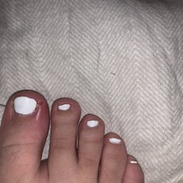 Uneven paint job, nails cut down to much and two days later this is what my big toe looked it. Uneven paint job, nails cut down to much and two days later this is what my big toe looked it.