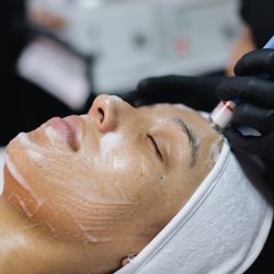 Kristen Marie - Wet/Dry Microdermabrasion Treatment