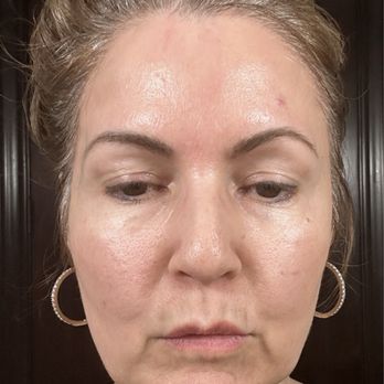 Athré Facial Plastics - Before photo - Cosmetic Surgeons Near Me - Houston, Texas Athré Facial Plastics - Before photo - Cosmetic Surgeons Near Me - Houston, Texas
