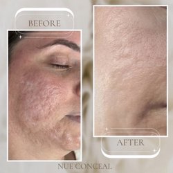 Stretch Mark. Inc