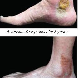 Suncoast Vein & Vascular Clinic