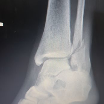 Richmond Bone & Joint Clinic - Before - Orthopedists Near Me - Katy, Texas Richmond Bone & Joint Clinic - Before - Orthopedists Near Me - Katy, Texas
