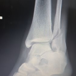 Richmond Bone & Joint Clinic - Before
