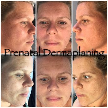 Advanced Permanent Cosmetics by K & V - Skin Care Near Me - Palm Beach Gardens, Florida Advanced Permanent Cosmetics by K & V - Skin Care Near Me - Palm Beach Gardens, Florida