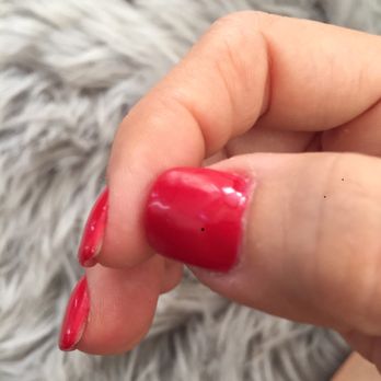 Envy Nails And Spa - You can see the nail totally lifted from the deep in, and it's been only two days - Nail Salons Near Me - Melbourne, Florida