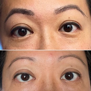 BrowTendre - Ugh. Look at my sad before picture. Spent a year in a pandemic and yeesh! Thanks stimulus check! - Eyelash Service Near Me - Glendale, California BrowTendre - Ugh. Look at my sad before picture. Spent a year in a pandemic and yeesh! Thanks stimulus check! - Eyelash Service Near Me - Glendale, California