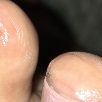 Polished Bar - Cut on two of my toes. Neosporin is covering the depth of the cuts. - Nail Salons Near Me - Orange, California Polished Bar - Cut on two of my toes. Neosporin is covering the depth of the cuts. - Nail Salons Near Me - Orange, California
