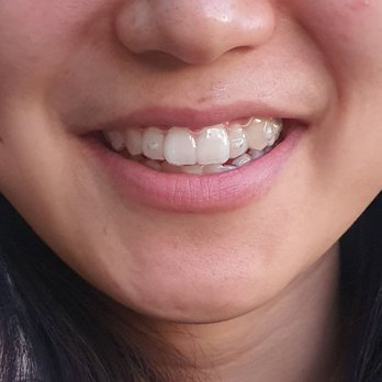 KS Dental - Cosmetic Dentists Near Me - Westminster, California KS Dental - Cosmetic Dentists Near Me - Westminster, California