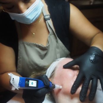 Grove and Kane - Microneedling + Growth Factor Drench with SkinPen® - Skin Care Near Me - Everett, Washington Grove and Kane - Microneedling + Growth Factor Drench with SkinPen® - Skin Care Near Me - Everett, Washington