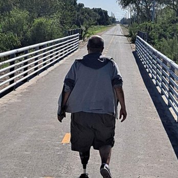 Prosthetics At Home - Prosthetics Near Me - San Antonio, Texas Prosthetics At Home - Prosthetics Near Me - San Antonio, Texas