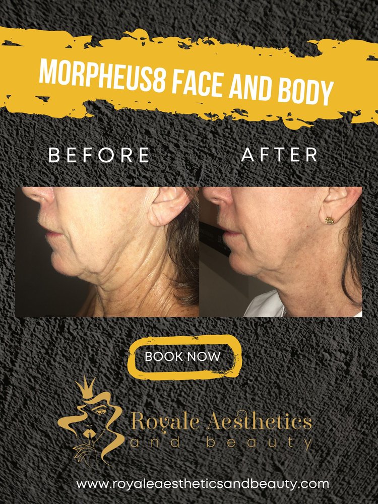 ROYALE AESTHETICS AND BEAUTY Request an Appointment 43 Photos 805