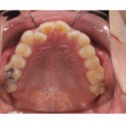 Markham Orthodontics - 2021 when I started