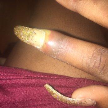 Sparkle Nails - THIS IS THE SECOND WEEK PRIOR TO MY VISIT . - Hair Removal Near Me - Oklahoma City, Oklahoma