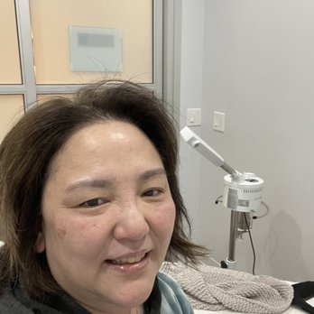 Beauty by Jingmei-ko - Another pic after a hydrojelly facial! - Estheticians Near Me - Torrance, California