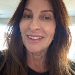 Youthful Spirit Aesthetics - This is minutes after I walked out of her office so excuse my no makeup, messy hair but the smile is pure joy from seeing the results!