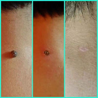 YOUNG SKIN CARE - 79 Photos - 14936 Northern Blvd, Flushing, New York