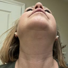 Scarring and loose skin