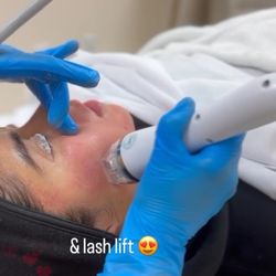 Iluxe Glo - MICRONEEDLING + lash lift