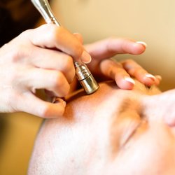 Micodermabrasion Facial