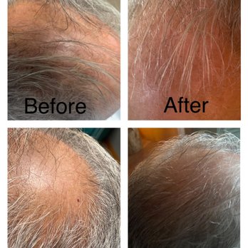 Aesthetics by Alicia - Aesthetics by Alicia all natural hair restoration. Call for appointment. 928-303-2329. - Aestheticians Near Me Aesthetics by Alicia - Aesthetics by Alicia all natural hair restoration. Call for appointment. 928-303-2329. - Aestheticians Near Me