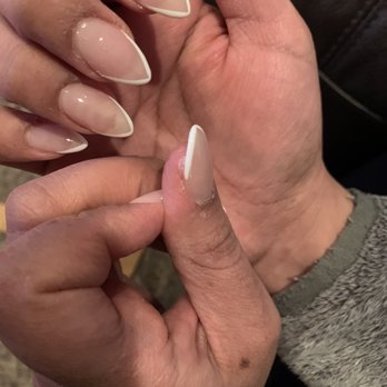 Collegeville Nails - Sealed my nail to my skin & my old fills are completely visible - Nail Salons Near Me - Collegeville, Pennsylvania Collegeville Nails - Sealed my nail to my skin & my old fills are completely visible - Nail Salons Near Me - Collegeville, Pennsylvania