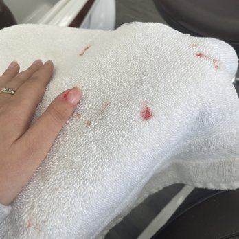 Starlight Nail & Spa - There was more blood on the other side of towel . - Nail Salons Near Me - Pico Rivera, California Starlight Nail & Spa - There was more blood on the other side of towel . - Nail Salons Near Me - Pico Rivera, California