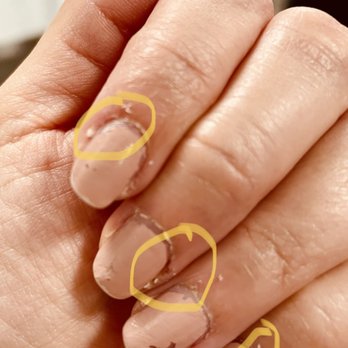 Le Petit Nail Spa - After 5 days manicure is a mess including scab - Skin Care Near Me - Berkeley, California Le Petit Nail Spa - After 5 days manicure is a mess including scab - Skin Care Near Me - Berkeley, California