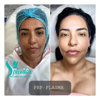 Splendor Wellness Center & Spa - Skin Care Near Me - Lake Worth, Florida Splendor Wellness Center & Spa - Skin Care Near Me - Lake Worth, Florida