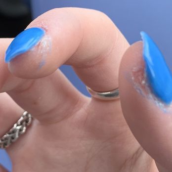 Creative Nails & Spa - Millbury - This hand was even worse & she proceeded to tell me it was "fine". - Nail Salons Near Me - Millbury, Massachusetts Creative Nails & Spa - Millbury - This hand was even worse & she proceeded to tell me it was "fine". - Nail Salons Near Me - Millbury, Massachusetts