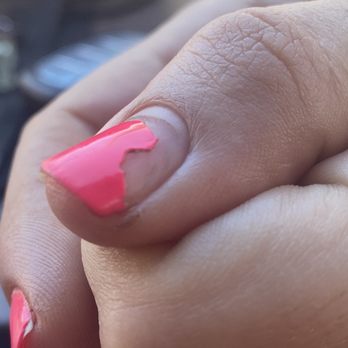 Joy Nails & Spa - Side view of the damage shows a deep groove in my nail from aggressive use of a drill to remove gel manicure - Nail Salons Near Me - Oceanside, California Joy Nails & Spa - Side view of the damage shows a deep groove in my nail from aggressive use of a drill to remove gel manicure - Nail Salons Near Me - Oceanside, California