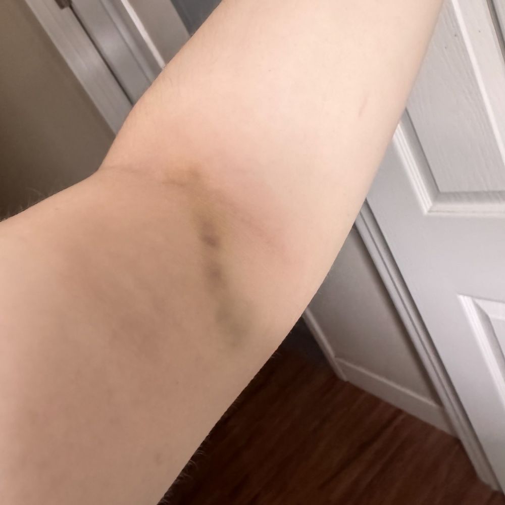 2 days after 2 days after