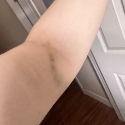 2 days after