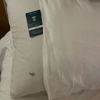 Eden Roc Resort Miami Beach - Blood stains visible due to too short pillowcase. - Resorts Near Me - Miami Beach, Florida