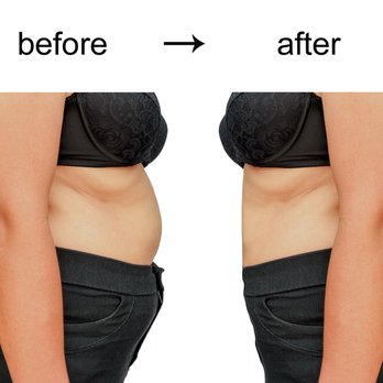 Slender Body & Mind - Lose Inches Today! - Body Contouring Near Me - Seattle, Washington Slender Body & Mind - Lose Inches Today! - Body Contouring Near Me - Seattle, Washington