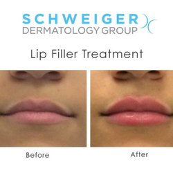 Schweiger Dermatology Group