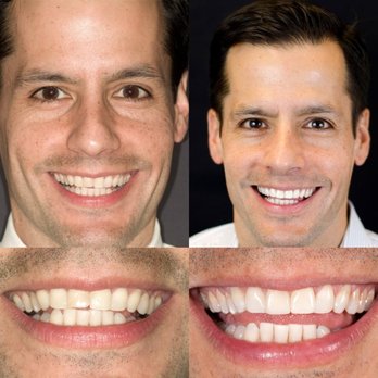 James B. Polley - Cosmetic Dentists Near Me - Las Vegas, Nevada