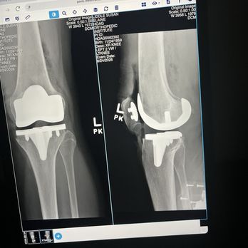 Stephen Mikulak, MD - New knee! - Orthopedists Near Me - Newport Beach, California Stephen Mikulak, MD - New knee! - Orthopedists Near Me - Newport Beach, California